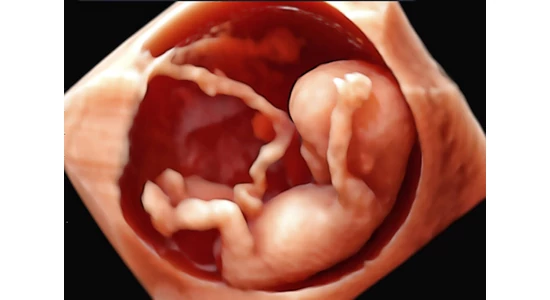 5d ultrahang - Hogy képzelj el egy ilyen vizsgálatot?
